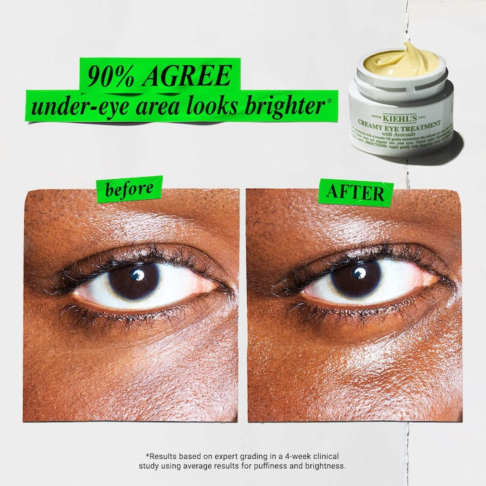 Radiant & Replenished Eyes Gift Set / Sephora Sales