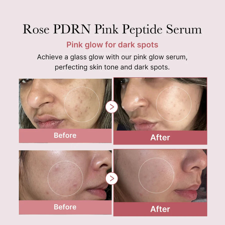 PDRN Pink Peptide Serum / Medicube