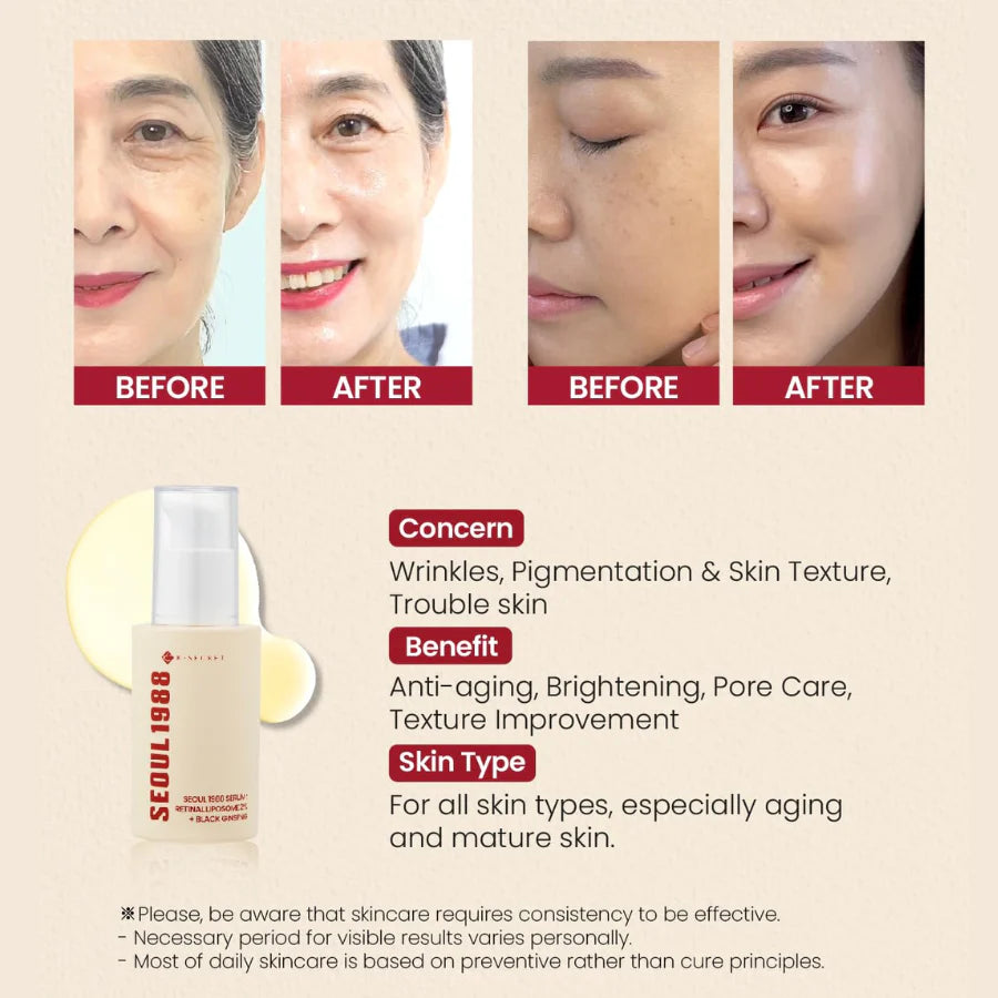Sérum Facial Seoul 1988 Serum: Retinal Liposome 2% + Black Ginseng / SEOUL 1988 (K-Secret)